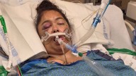 'I Shot Her': Gillette Woman Shot In Head Remains On Life Support, Man Charged