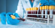 Roche, Lilly's blood test for Alzheimer's diagnosis gets US approval