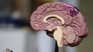 Poor Sleep And Heart Issues May Hinder Brain Waste Clearance, Raising Dementia Risk: Study