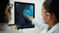 ¿Qué son las células T reguladoras en el cuerpo? Estudio al que se le reconoció con el Nobel de Medicina 2025