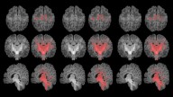 La contaminación durante el embarazo ralentiza la maduración del cerebro en recién nacidos