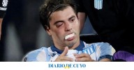 Santiago Sosa sufrió una fractura en su rostro tras el codazo que recibió de Marcos Rojo