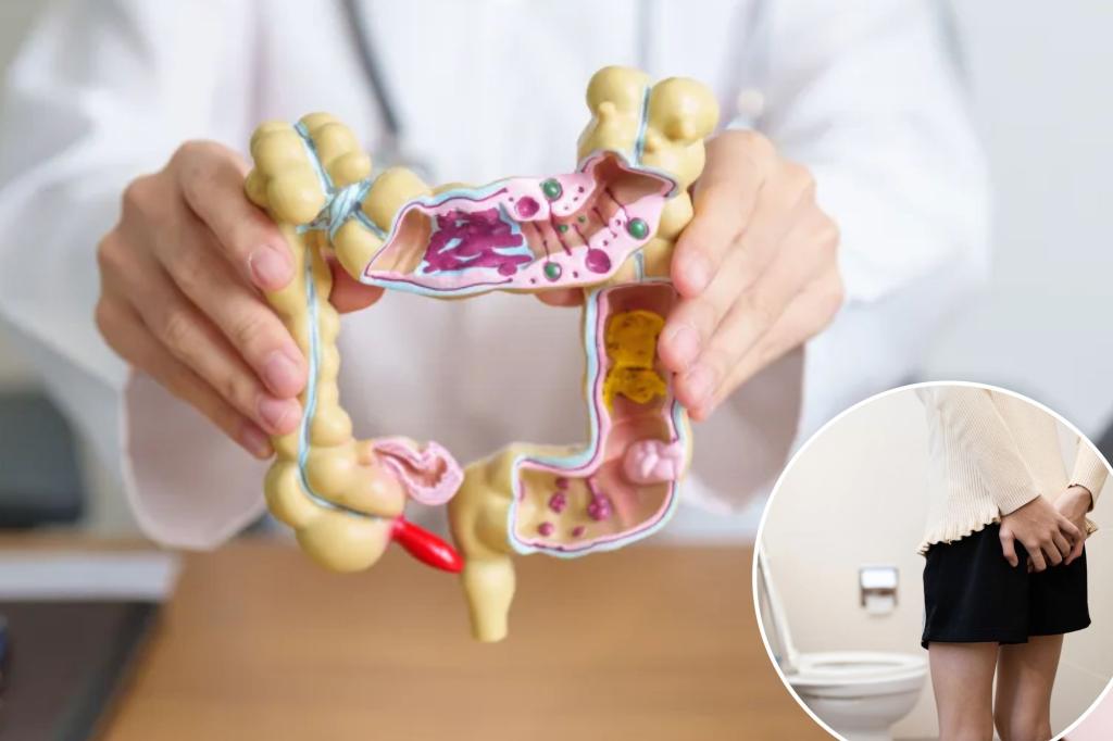 'Strongest predictor of colorectal cancer' under 50 revealed