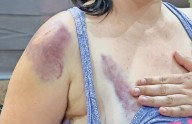 Fácil, acceder a redes que incitan agresiones