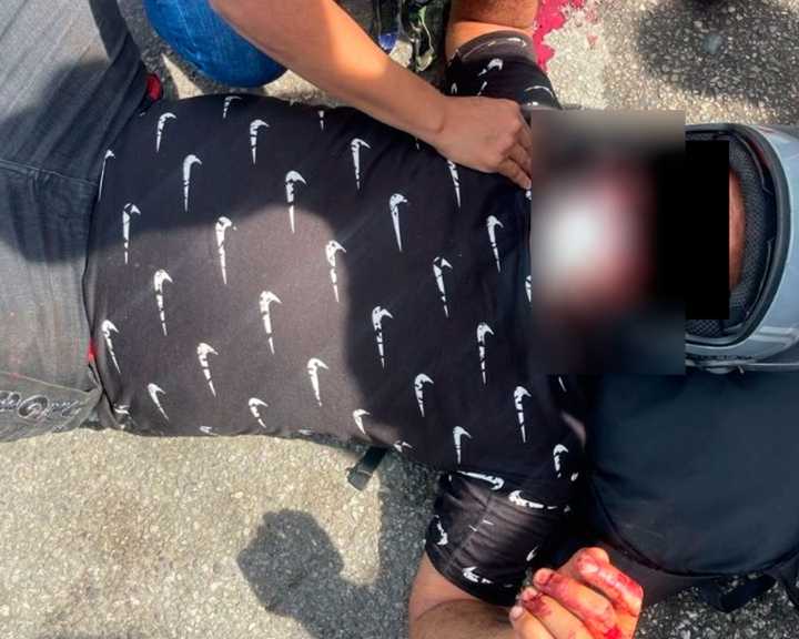 Choque entre motos dejó dos heridos en Maracay
