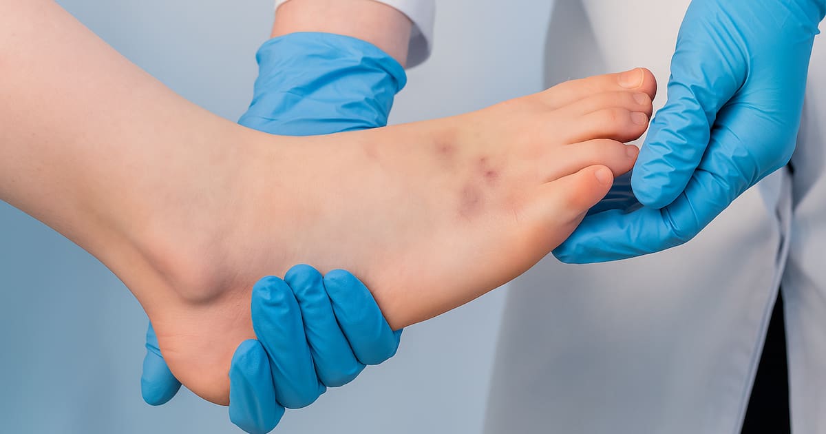 Suspenden clases por virus de Coxsackie