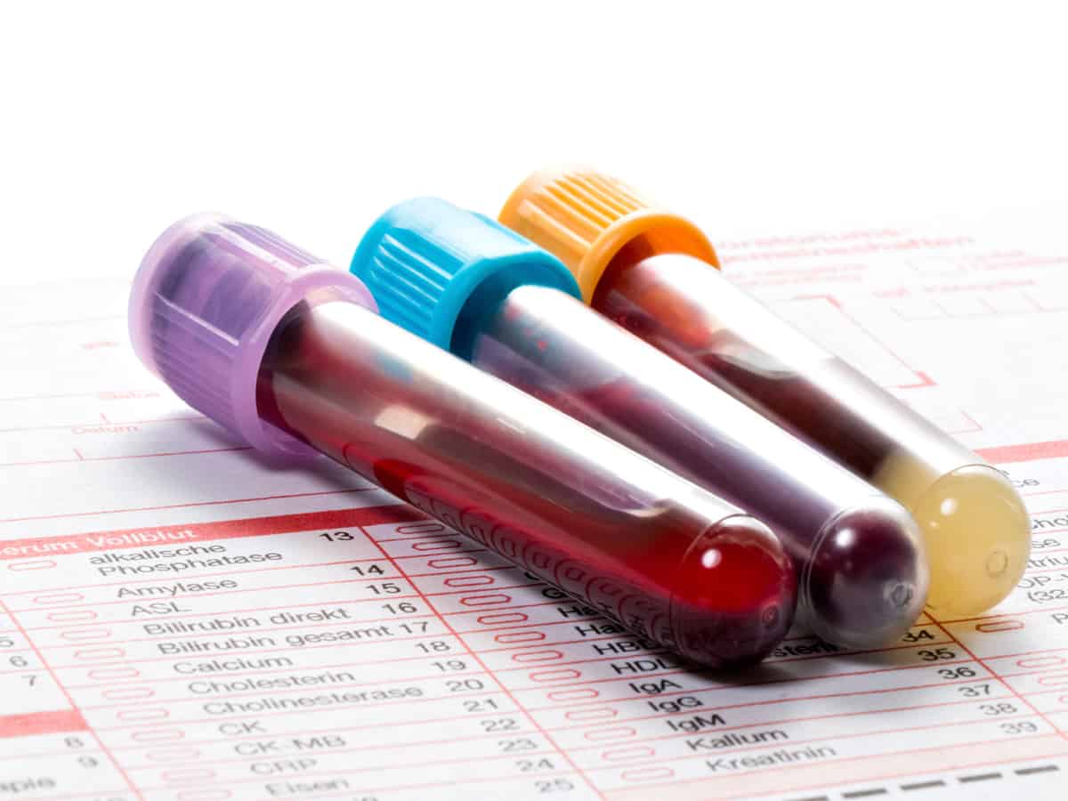HC orders Rs 2 lakh payout after govt hospital reveals woman’s HIV status