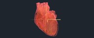 Huge Study Links 99% of Heart Attacks And Strokes With Four Risk Factors