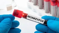 First Case Of New Mpox Variant Detected In Netherlands