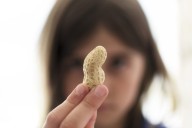 Peanut allergies have fallen because of infant exposure, study says