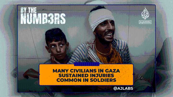 Many civilians in Gaza sustained injuries common in soldiers