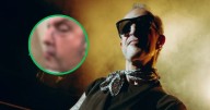 Tito Fuentes de Molotov muestra su rostro desfigurado tras 11 cirugías y quedar en coma