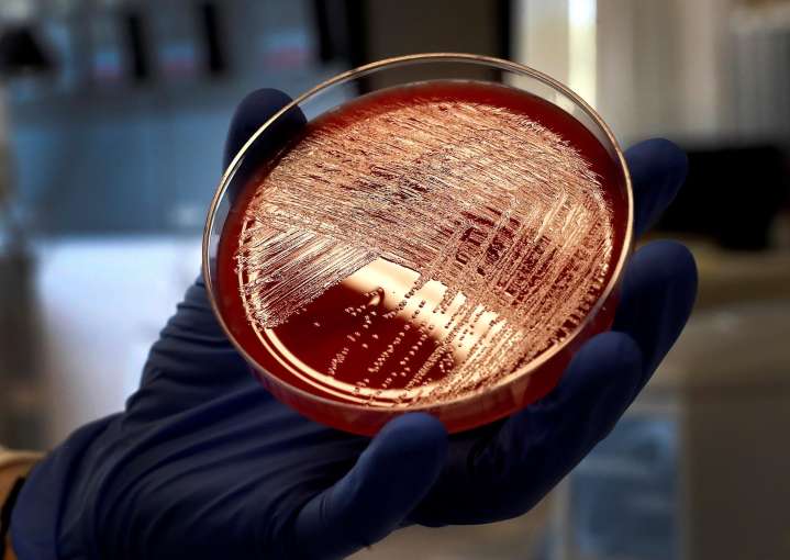 Florida prepara una lucha contra las superbacterias desde las aulas de secundaria
