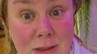 I've lost weight but now I've got a 'neck vagina' - I can't afford surgery so people tell me to 'tape it behind my ears'
