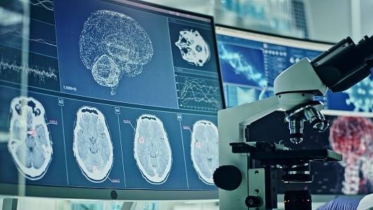 Why young Indians under 40 need to pay attention to stroke symptoms