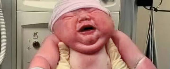 'Giant' Baby Born in The US Is No Record. Here's The Science of Big Births.