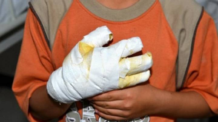 Revelan detalles de la tragedia: niños heridos por artefacto explosivo en San Andrés de Cuerquia