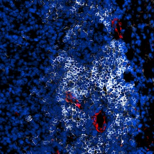 Immune therapy boosts chances against cancer