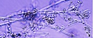Bandages Made From Living Fungi Could Be The Future of Wound Healing