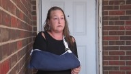 ‘I was fighting for my life': Woman mauled by pit bull in Lake Worth seeks change