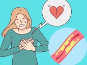 Infarto, embolia o derrame cerebral: en qué se diferencian