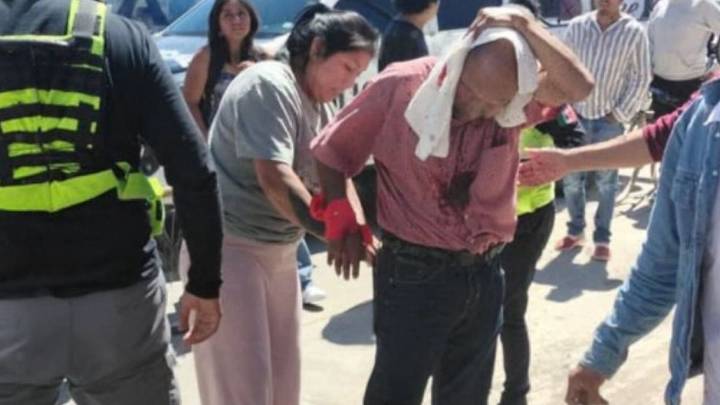Policía Municipal de Coronango abate a presunto agresor que atacó con un machete a oficiales