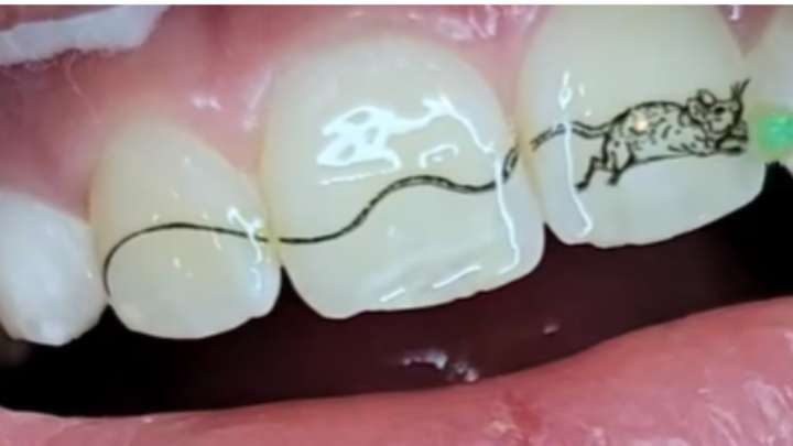 En fotos | La tendencia de los tatuajes en los dientes, de moda entre los jóvenes en China, que genera preocupación entre expertos