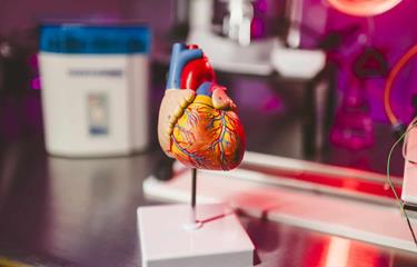 Factores que están detrás de infartos y ataques cerebrovasculares