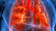 Improved living conditions and sustained policies can ease lung diseases burden, experts say