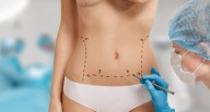 Cirugía estética, cuando la belleza cuesta la vida