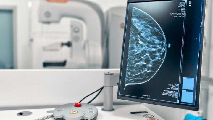 La ministra de Sanidad pide a las comunidades autónomas los datos de cribado de cáncer de mama: "Han desprotegido a las mujeres"