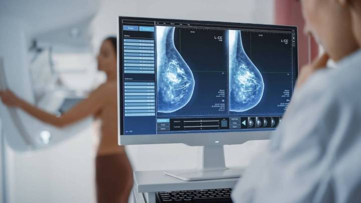 Qué son los conjugados anticuerpo-fármaco, el nuevo avance que supera a la quimioterapia para tratar el cáncer de mama triple negativo