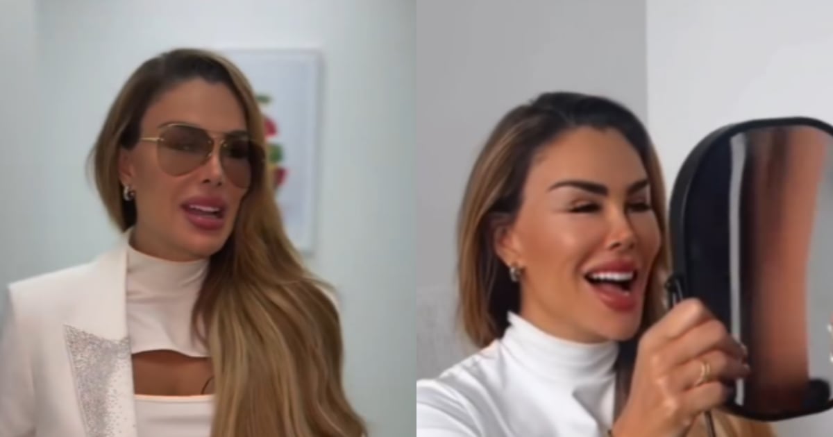 Ninel Conde cambia el color de sus ojos con cirugía; ¿cuánto cuesta y de qué se trata?