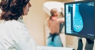Missing the first mammogram linked to increased risk of breast cancer death, new study suggests