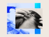 A new laser hair-loss treatment aims to be like going to the dentist twice a year