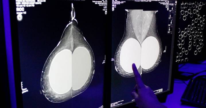 ¿Qué sabemos del Laboratorio Nacional de Inteligencia Artificial y cómo ayudaría para detectar el cáncer?