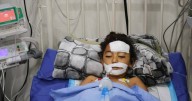 A bomb in Gaza wounds twins who thought it was a toy