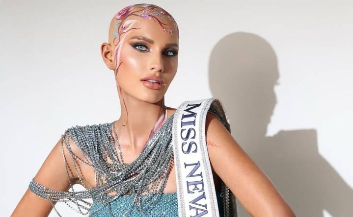Mary Sickler hace historia como la primera mujer con alopecia en competir por Miss Estados Unidos