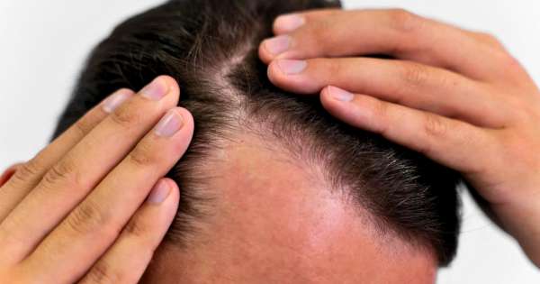 Adiós a la caída del cabello: el nuevo suero capilar que hace crecer el pelo en tan solo dos semanas