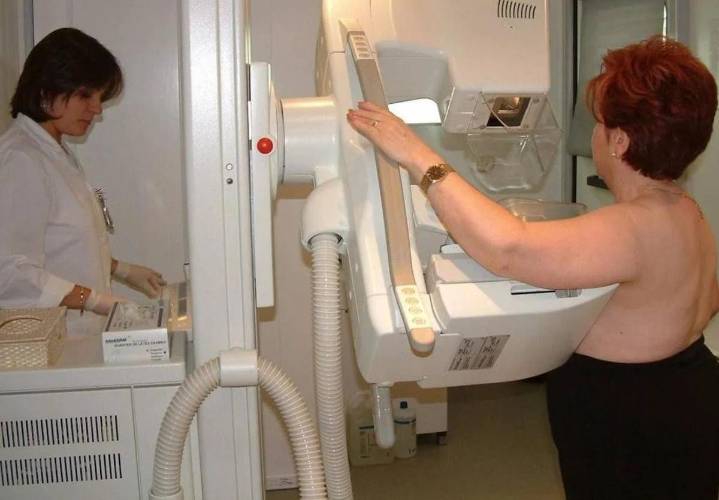 Sanidad dice que «ya están citadas» las 247 mujeres con resultado dudoso en el cribado