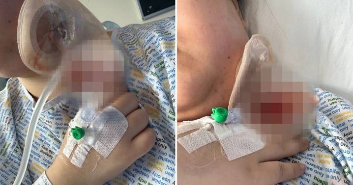 Glasgow woman has 'knife wound' scar on neck after hospital surgery for infection