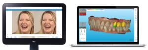 Align Technology Announces New Innovations for iTero™ Digital Solutions, a Comprehensive Ecosystem That Includes Intraoral Scanners and Integrated Software Tools That Enhance the Chairside Patient Exp