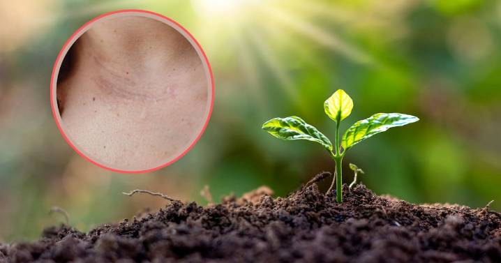 Descubren la planta que acelera la cicatrización y actúa como laxante natural