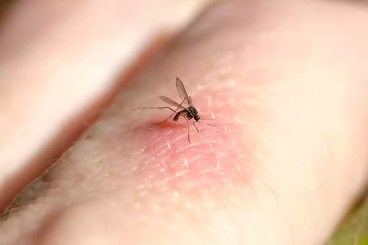 Mosquitos en Yucatán: cómo distinguir entre picaduras comunes y las de dengue, chikungunya o zika