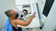 Al año, invierte Gobierno 4 mil 200 mdp en atender el cáncer de mama
