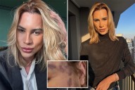 Influencer Adair Mendes Dutra dead after complaining about 'fox eyes' cosmetic surgery