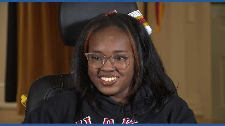'You're still going to be you no matter what': Shaker Heights teen stands with dance team months after losing leg