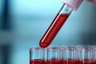 More Hemophilia Treatment Choices Despite Gene Therapy Setbacks