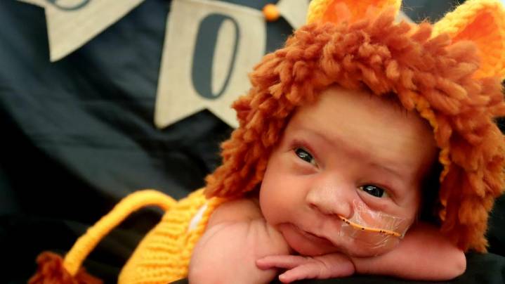 Louisville hospitals dress NICU babies in their first Halloween costumes