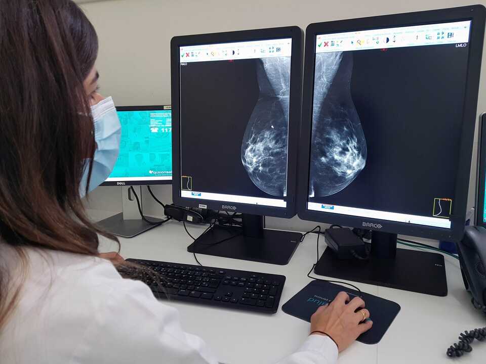 Todos los grupos, salvo PP, aprueban citar antes de diciembre a las mujeres pendientes de pruebas del cáncer de mama